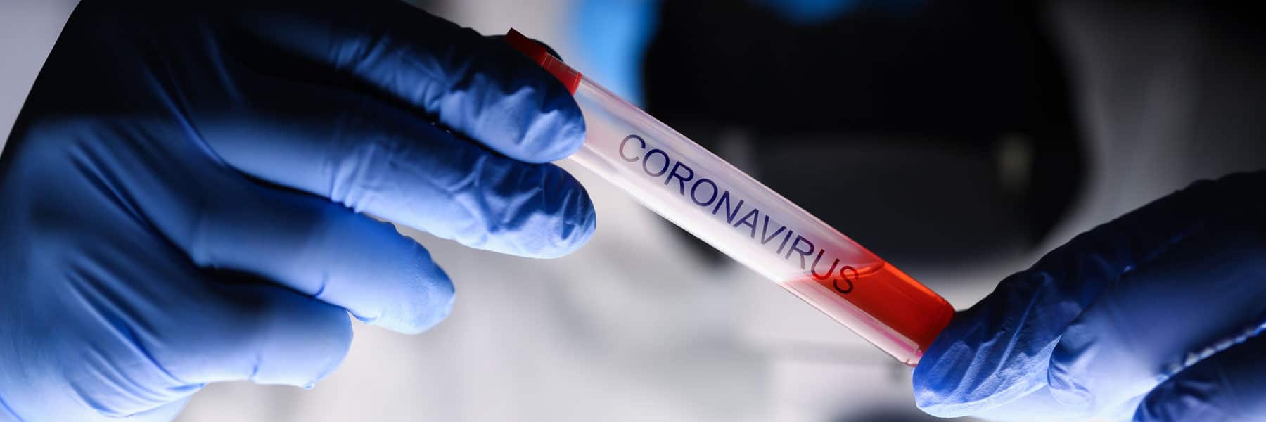 What is the Coronavirus (COVID-19)? 
